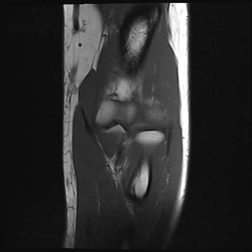 Click on the Serie image to view the images of Wieszt, Gnter